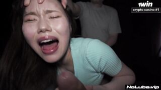 Large Knobs For Oriental Teens