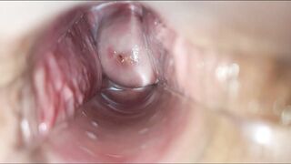 inside vagina