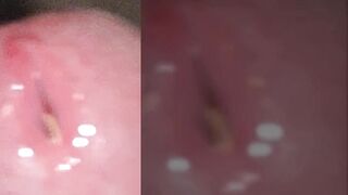 Playing With Zoom Levels