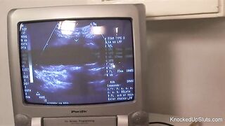 Slutty doctor used an opportunity to bang his preggo patient, becayse they were one as well as the other very lewd