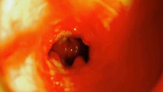 The path into the depths and moist splashes