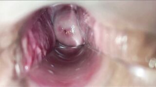 inside vaginal