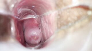 Speculum inside vagina