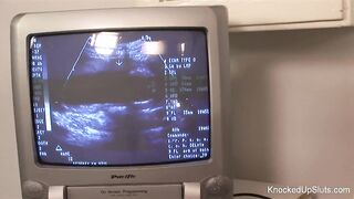 Preggo redhead sucks & bangs at the doctors