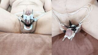 Enormous ESTIM Force on the shaft